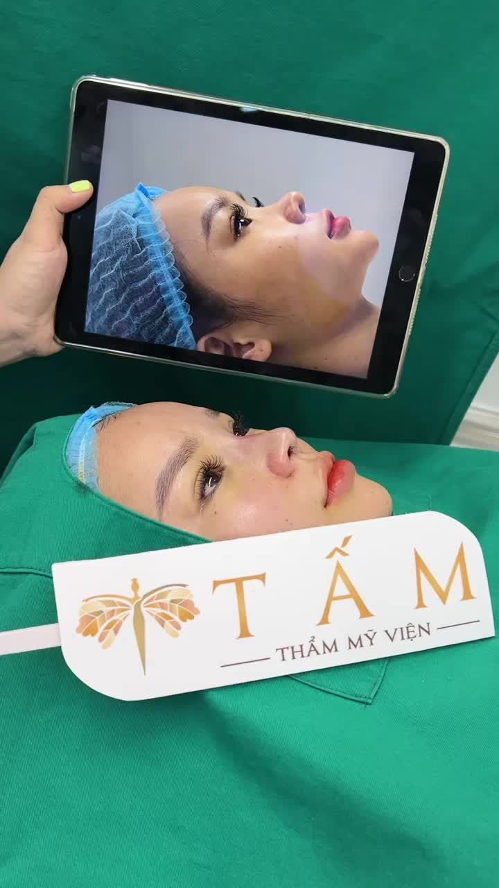 Hình ảnh trực quan nhất về thay đổi trước sau nâng mũi chính là livestream ngay tại phòng khám